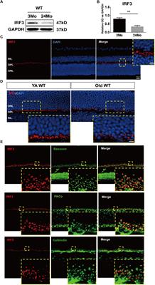Interferon Regulatory Factor 3 Deficiency Induces Age-Related Alterations of the Retina in Young and Old Mice